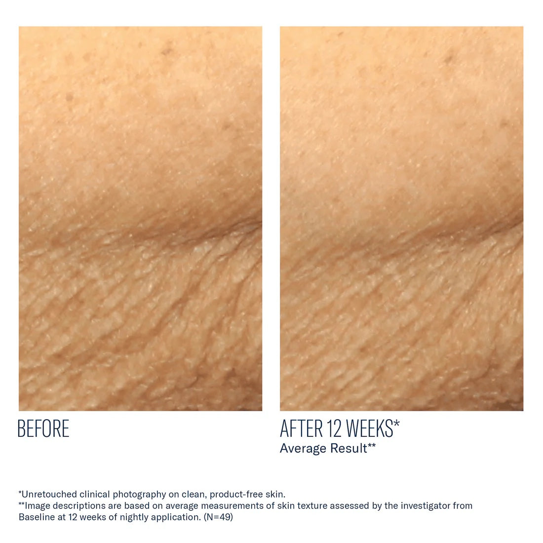 AlphaRet Body Overnight Cream