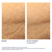 AlphaRet Body Overnight Cream