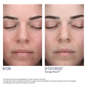 AlphaRet Clearing Serum
