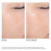 AlphaRet Exfoliating Peel Pads