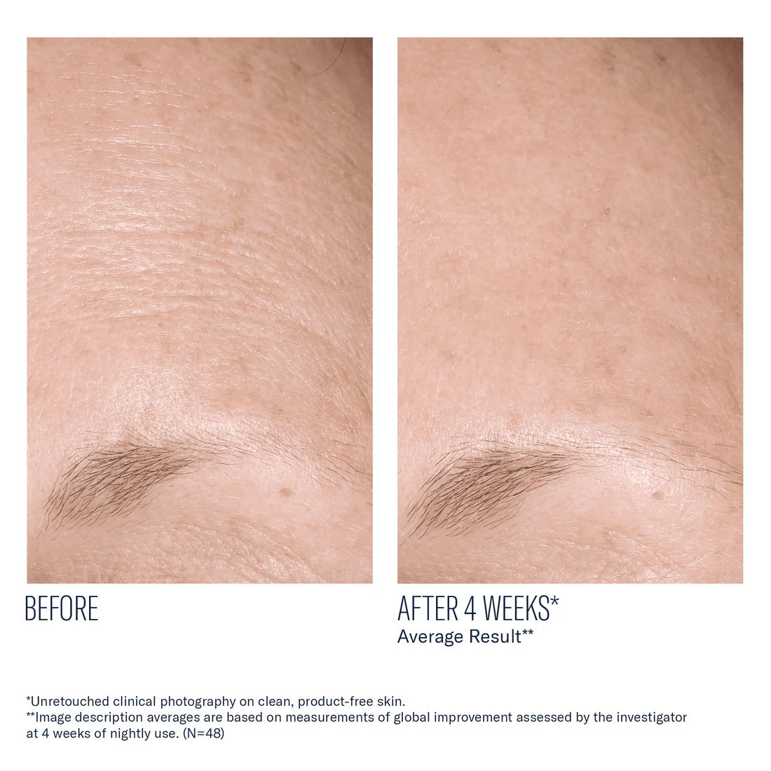 AlphaRet Overnight Cream