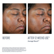 Even Intensive Skin Tone Correcting Serum