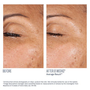 EyeMax AlphaRet Overnight Cream
