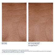 InterFuse Treatment Cream FACE & NECK
