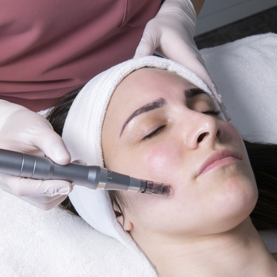 Microneedling 