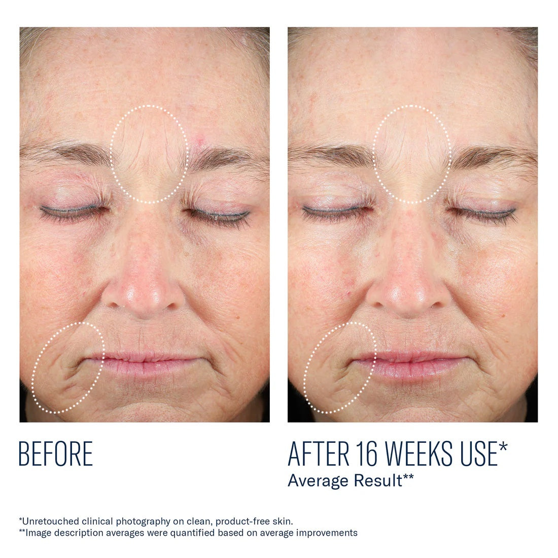 Mystro Revive Renewing Serum