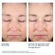 Mystro Revive Renewing Serum