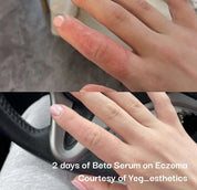 Beta-Glucan Serum