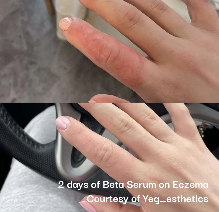 Beta-Glucan Serum