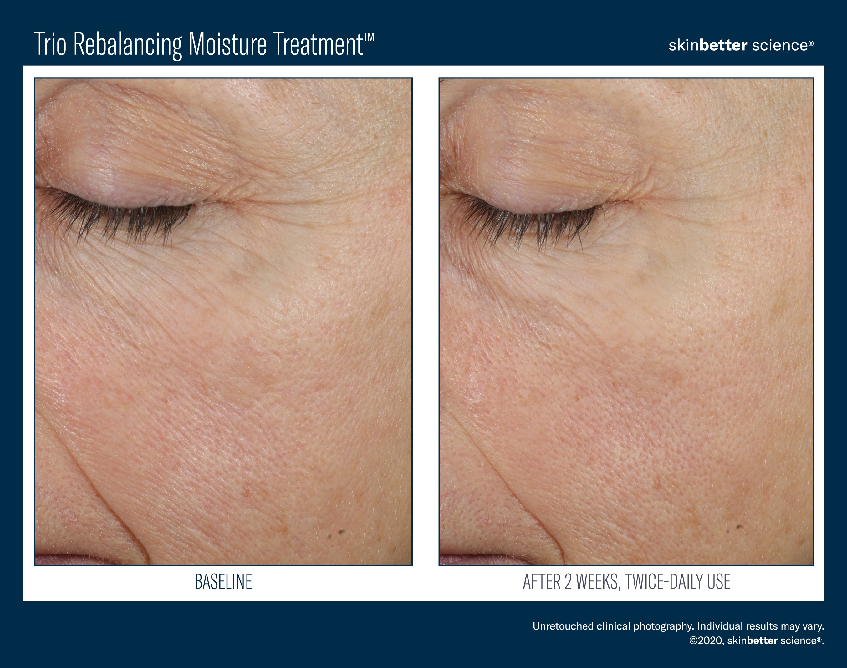 Trio Rebalancing Moisture Treatment