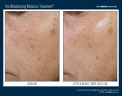 Trio Rebalancing Moisture Treatment