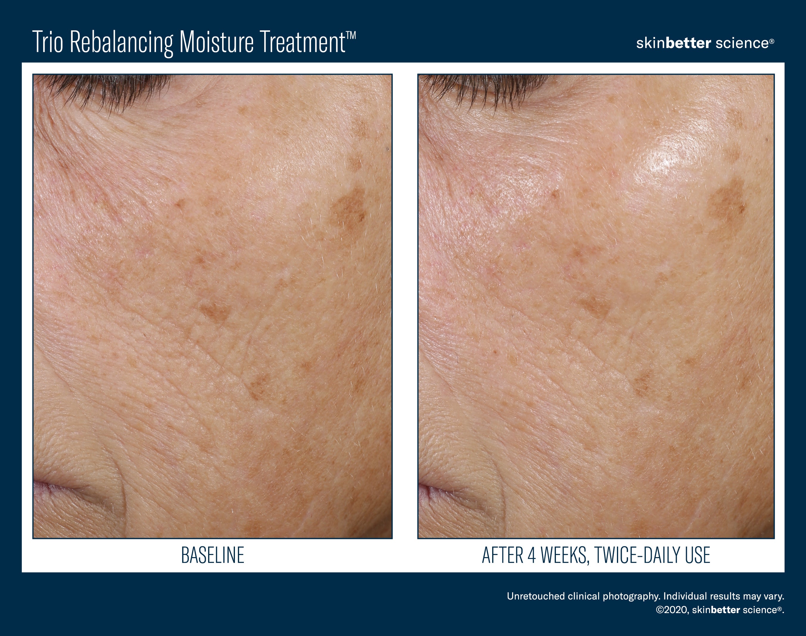 Trio Rebalancing Moisture Treatment