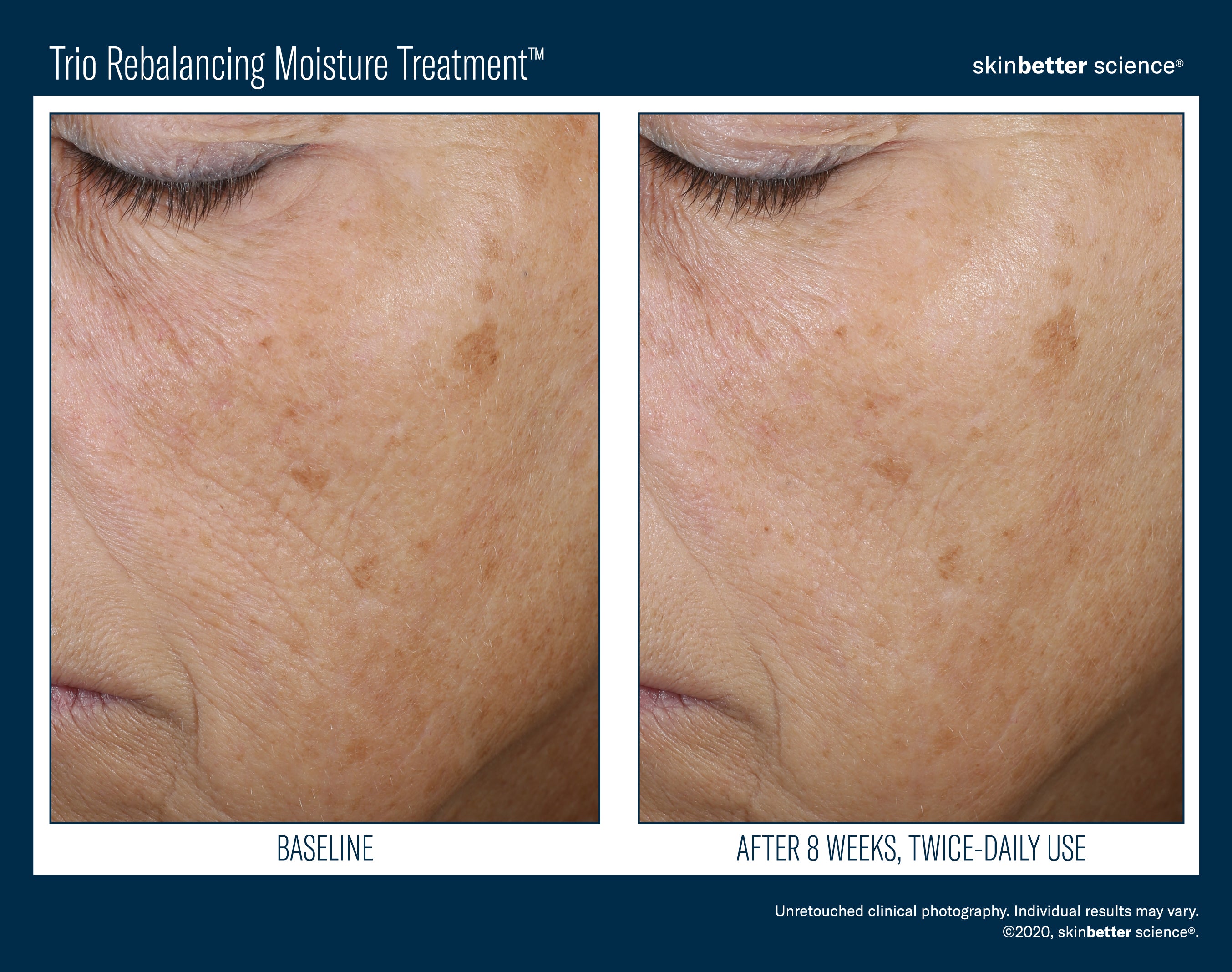 Trio Rebalancing Moisture Treatment