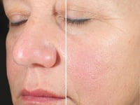 Alto Advanced Defense and Repair Serum